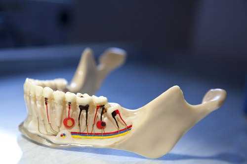 Если нерв удален, почему болит зуб?