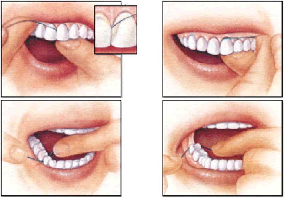Преимущества и технология процедуры удаления зуба ниткой — безопасность, эффективность и быстрота