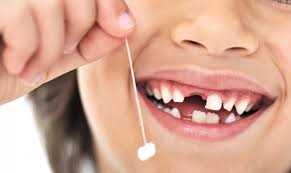 Почему иногда необходимо удаление зуба у подростков — причины, последствия и процесс проведения операции