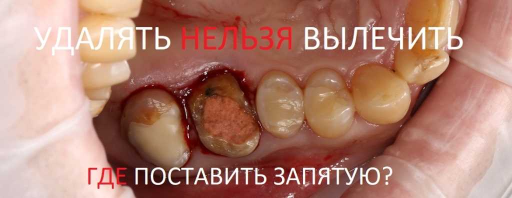 Симптомы воспаления зуба