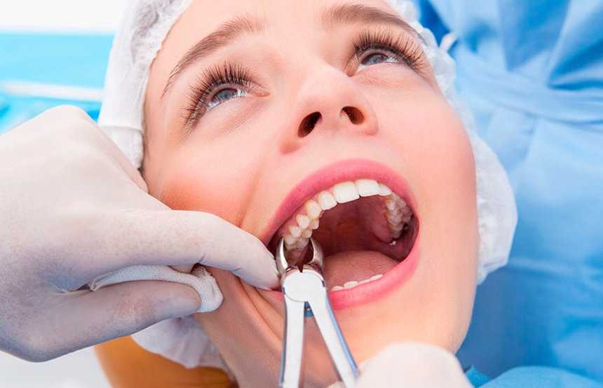 Сложное удаление зубов в отделении челюстно-лицевой хирургии