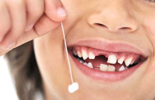 Удаление коренного зуба в домашних условиях