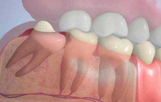 Преимущества атравматичного ультразвукового метода удаления зубов