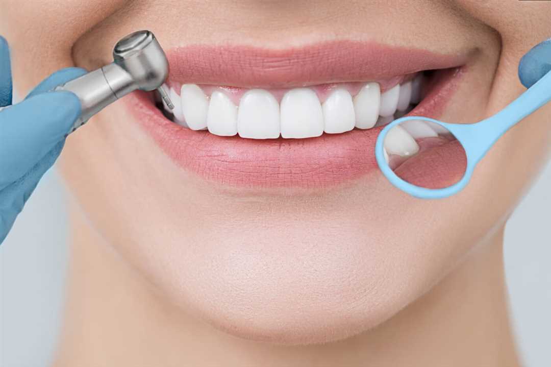 Что важно знать о зубном налете?
