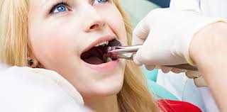 Удаление зубов клиника