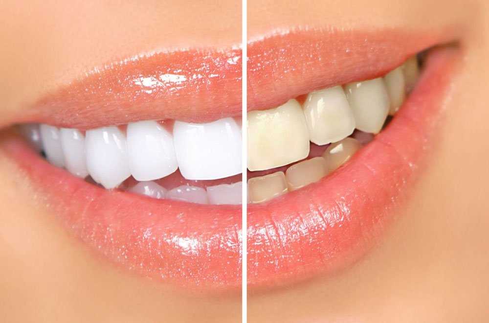Что делать, если вырвали зуб и появились такие симптомы?