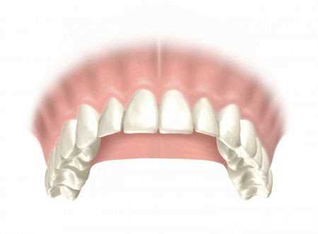 Прямая адгезивная реставрация зубов