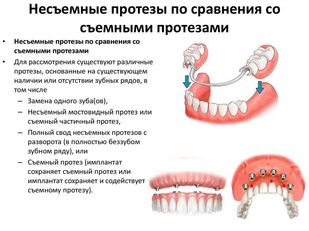 Показания к протезированию зубов