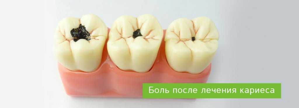Зуб начал сильно реагировать на холодное: что это значит и какие могут возникнуть осложнения