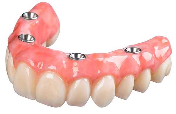 Зубы человека протезирование