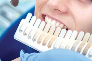 Как выбрать правильный цвет протезов для новых зубов и создать идеальную улыбку
