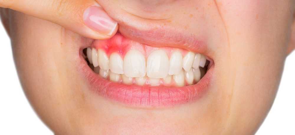 Почему болит зуб под протезом
