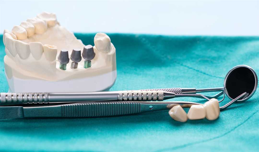 Почему важно восстанавливать утраченные зубы?
