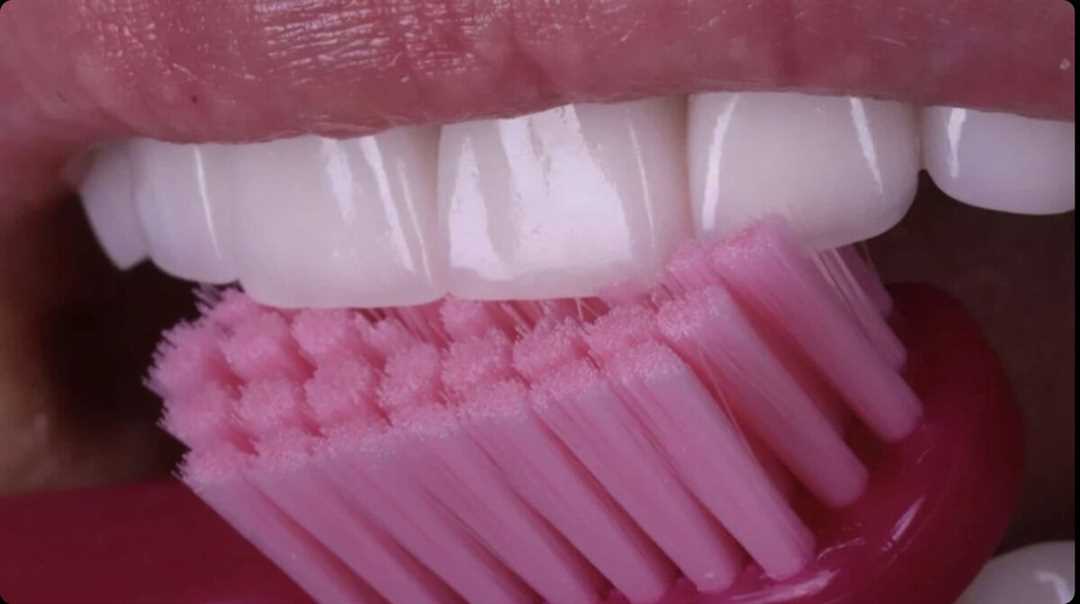 Зубные щетки от налета