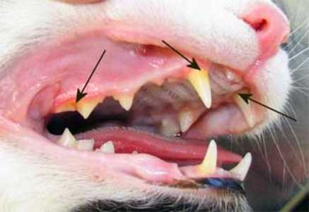 Причины возникновения зубного камня