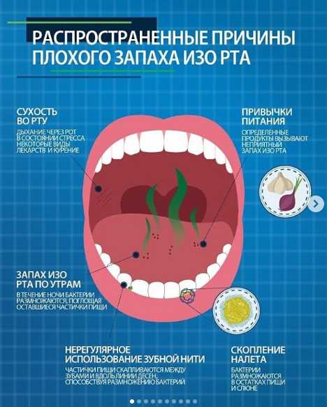 Избавляемся от неприятного запаха изо рта — причины образования зубного налета и способы борьбы с ним